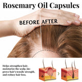 Rosemary Hair Care Capsules Nourish Hair Roots And Prevent Hair Loss Heaventlyshop